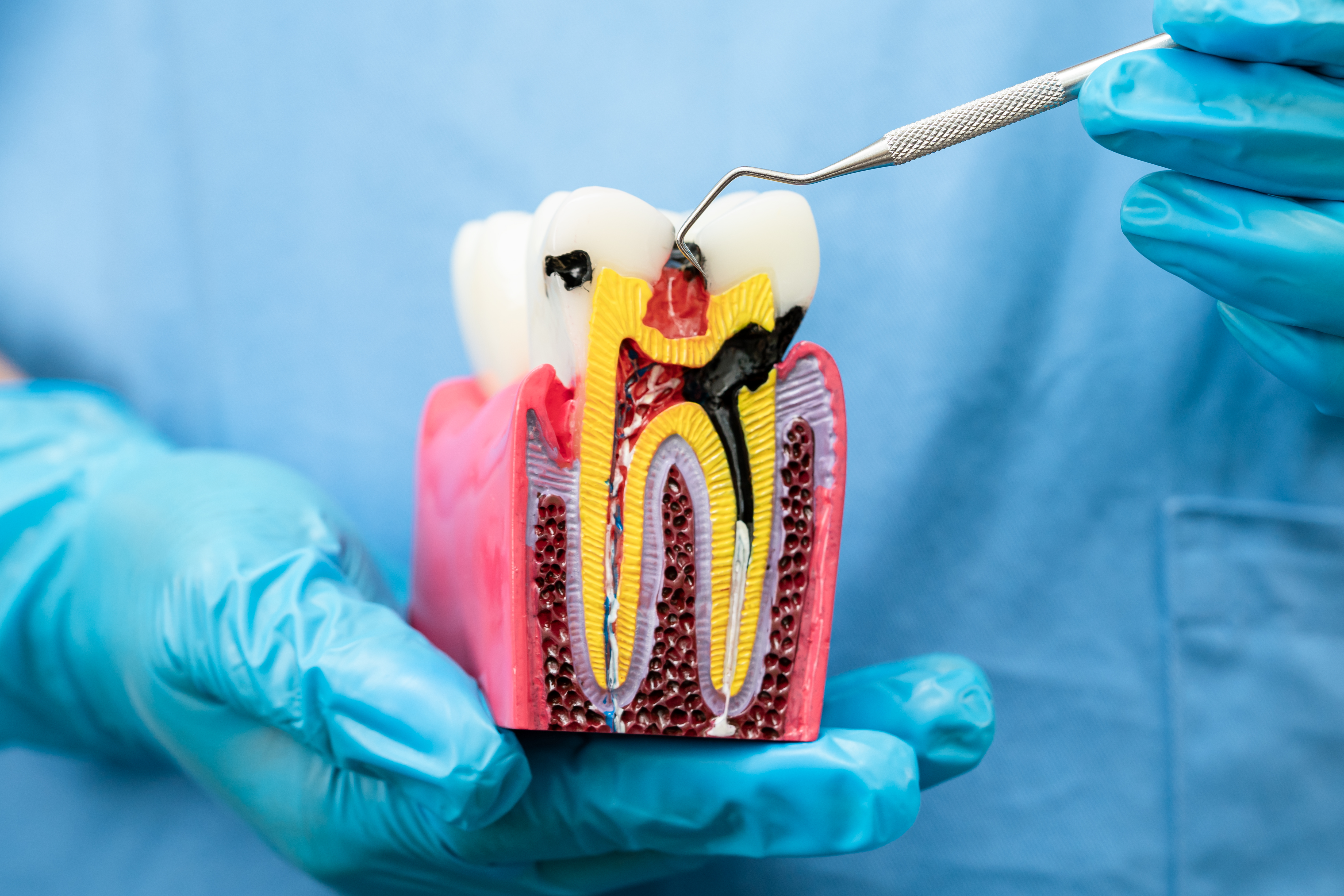 Endodontic Care
